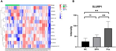 Unveiling the potential of SLURP1 protein as a biomarker for prostate cancer screening